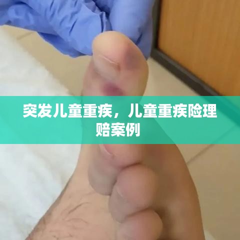 突发儿童重疾，儿童重疾险理赔案例 