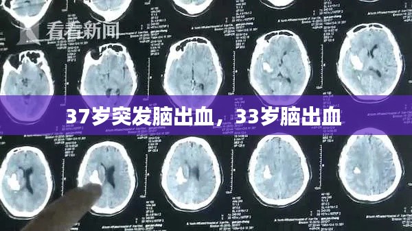 37岁突发脑出血，33岁脑出血 