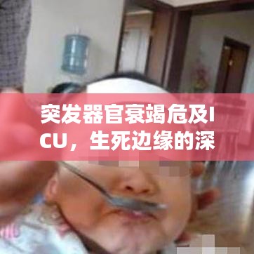 突发器官衰竭危及ICU，生死边缘的深度抢救与护理挑战