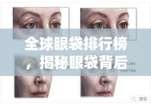 全球眼袋排行榜，揭秘眼袋背后的真相探究